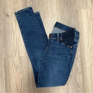 Madewell Dark Blue Skinny Jeans